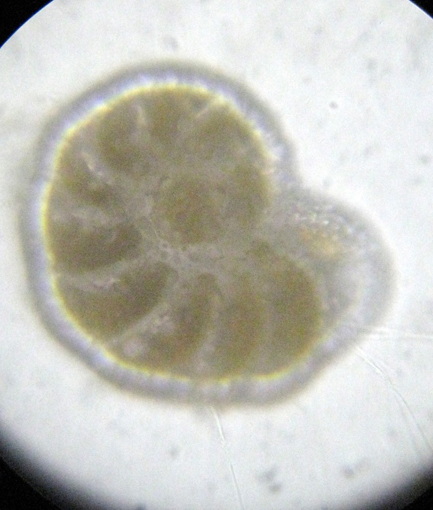 Direi Hyalinea balthica (Foraminifera)